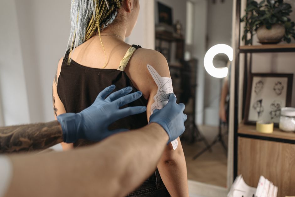eliminación tatuaje láser