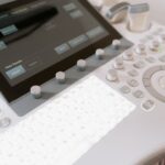 超音波診断装置 価格